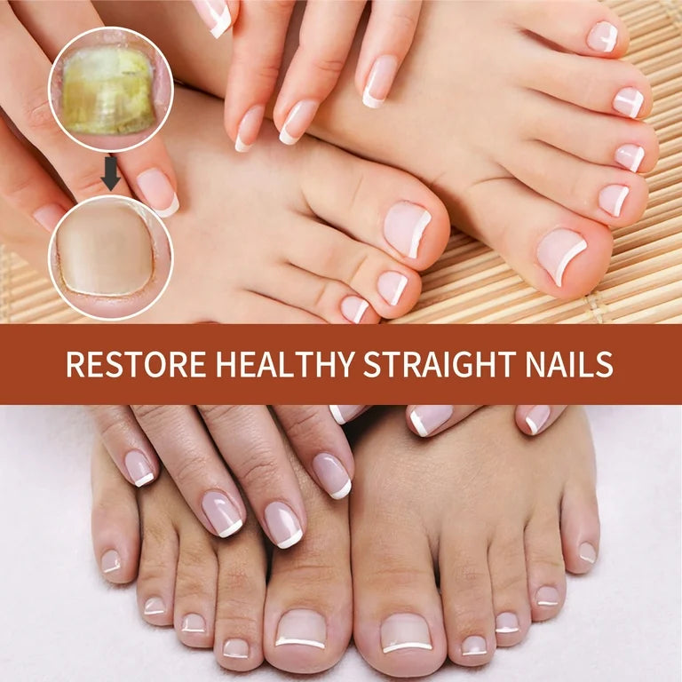 ABERA Nail Fungus Serum - Best Seller Store