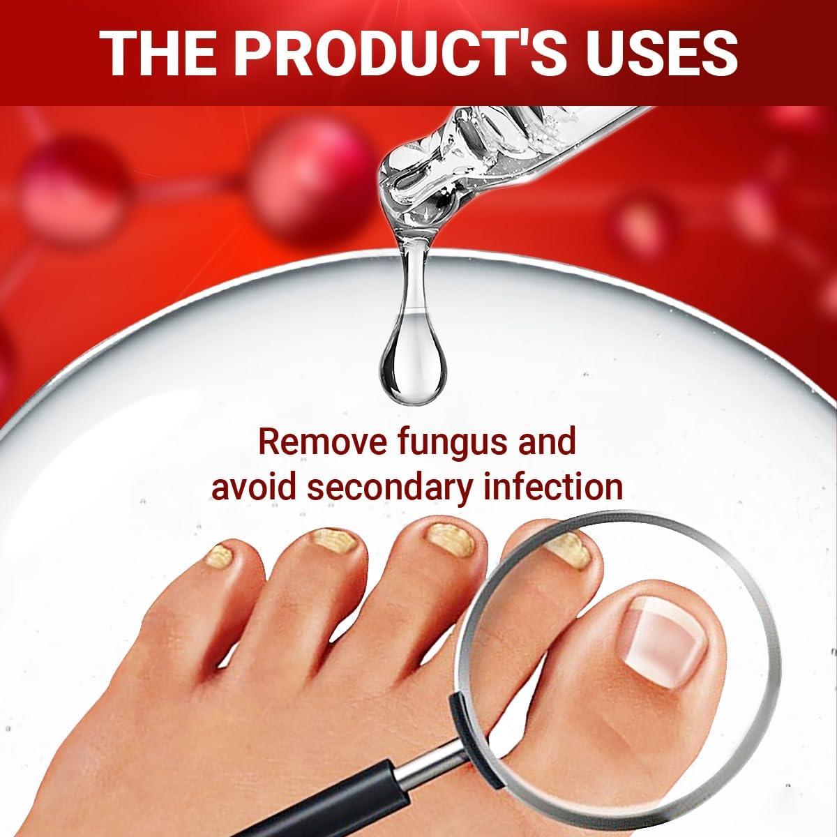 ABERA Nail Fungus Serum - Best Seller Store
