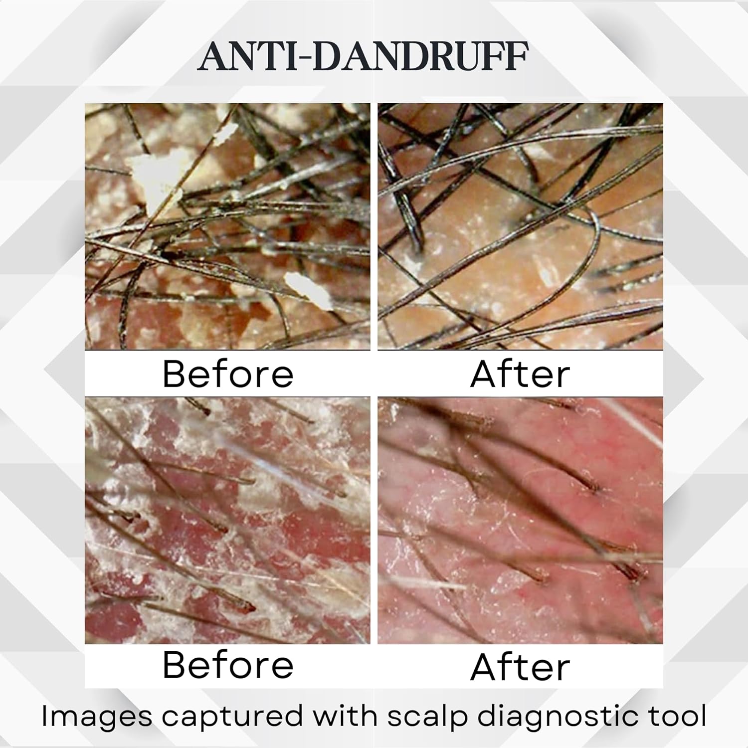 Amanda Shampoo - Best Seller - US